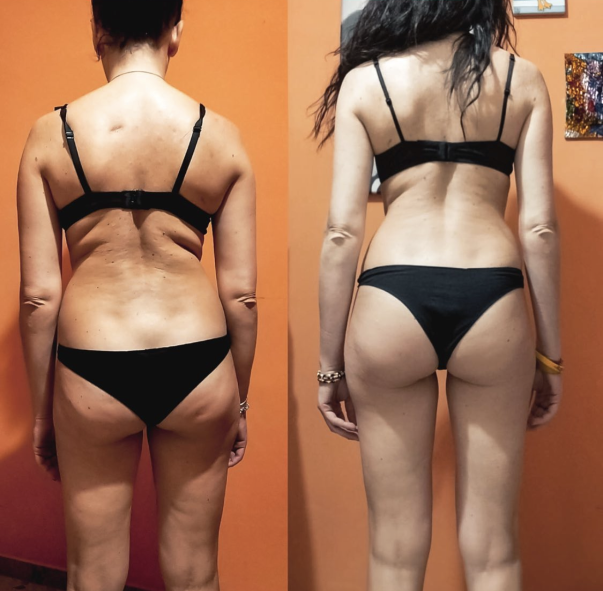 Foto prima e dopo di una partecipante BR Academy: confronto del corpo all’inizio e alla fine del percorso (6 di 7)