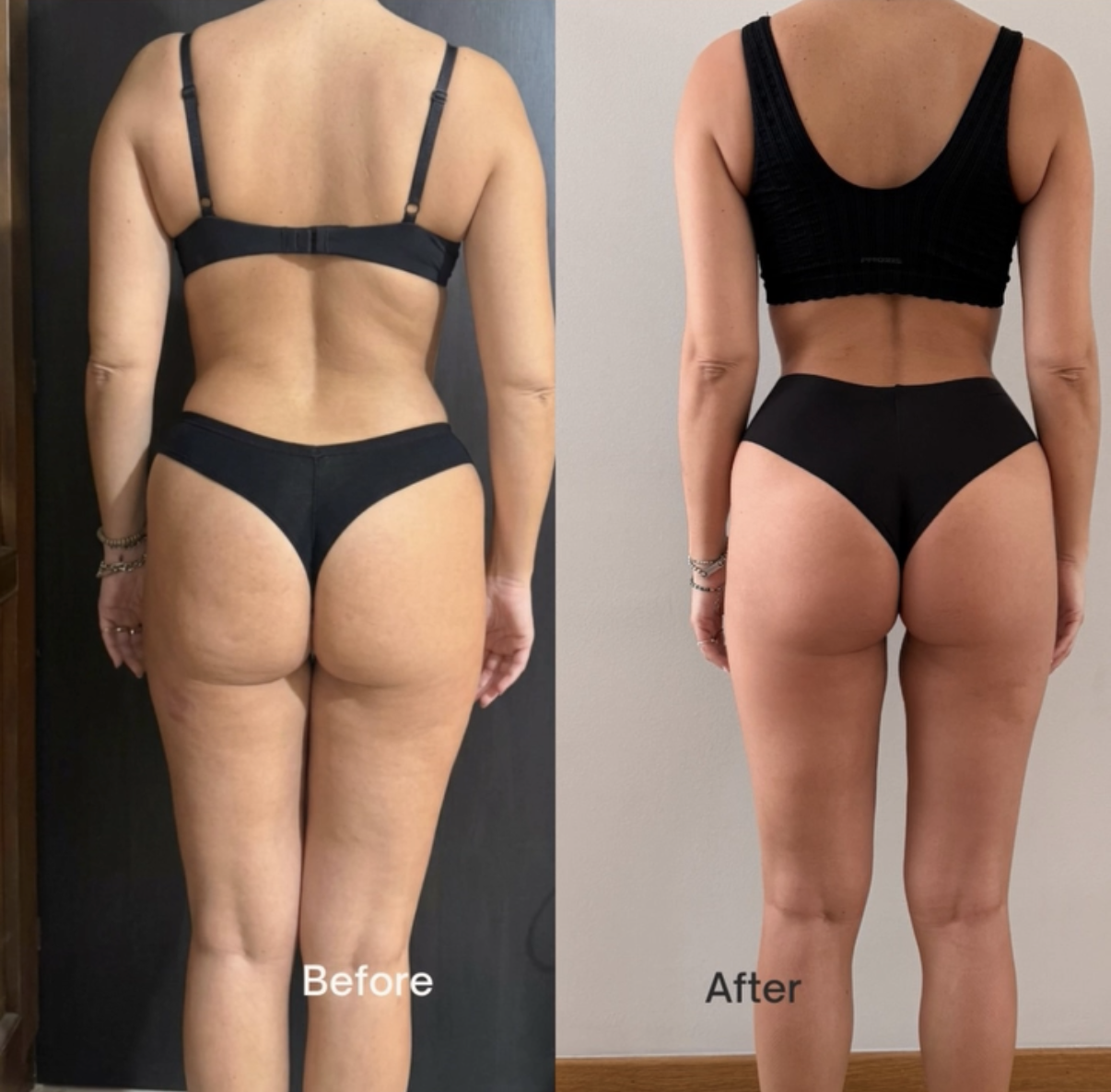 Foto prima e dopo di una partecipante BR Academy: confronto del corpo all’inizio e alla fine del percorso (3 di 7)